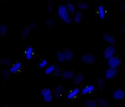 Immunocytochemistry/ Immunofluorescence: Aurora A [p Thr288] Antibody [NB100-2371]